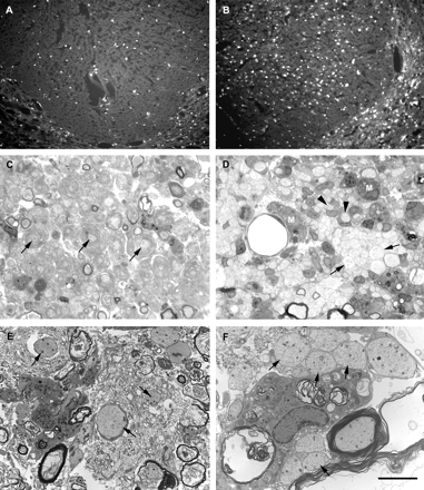 Lesions in the dorsal funiculus of animals treated with daily intraperitoneal injections of either dexamethasone (1.5 mg/kg; A, C and E) or saline (B, D and F) beginning 2 days before the injection of LPS. In A and B, epifluorescence micrographs illustrate the number of iNOS-positive cells present at the site of an injection of LPS 1 day earlier. Dexamethasone treatment (A) significantly reduced the number of iNOS-positive cells compared with saline treatment (B; see text for statistical analysis). C–F show light and electron micrographs of lesions in dexamethasone-treated (C and E respectively) and saline-treated (D and F respectively) animals 14 days after LPS injection. Saline-treated animals exhibit a lesion similar to that of untreated animals, with nests of packed demyelinated axons (e.g. arrows in D and F) and cell-associated demyelinated axons (e.g. arrowheads in D). Relatively small amounts of extracellular myelin debris are present at this time (e.g. upper left corner in F). Dexamethasone treatment does not prevent the demyelination, but does prolong the presence of debris, and the axons appear surrounded by whorls of disaggregated myelin (e.g. arrows in C and E). Comparing D with C, it is clear that debris-filled macrophages (e.g. M in D) are more prominent in lesions from animals treated with saline than in those treated with dexamethasone. Scale bar (shown in F) = 135 µm in A and B, 20 µm in C and D, and 5 µm in E and F.
