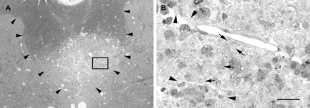 Lesion produced by the injection of highly purified LPS into the dorsal funiculus 10 days earlier. (A) Low-magnification light micrograph of a transverse section of the spinal cord at the level of the injection. The boundary of the dorsal funiculus is delineated by arrowheads, and a lesion comprising most of the deep half of the dorsal funiculus can be seen. In B, the region bounded by the box in A is shown at higher magnification. This region contains both demyelinated axons (e.g. arrowheads) and axons surrounded by myelin with an enlarged region between the compact myelin and the axon, consistent with vesiculation of the innermost lamellae (e.g. arrows), as illustrated in Fig. 3D. Scale bar (shown in B) = 200 µm in A and 20 µm in B.