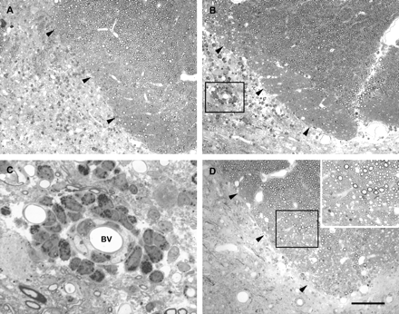 Light micrographs of the deep portion of the left dorsal column (margin indicated by arrowheads) 1 day (A), 3 days (B), and 5 days (D) after the injection of LPS into this region. Inflammatory cells are present, particularly surrounding blood vessels in the grey matter immediately adjacent to the dorsal funiculus. One such blood vessel, outlined by the box in B, is shown at higher magnification in C. Both mononuclear cells and PMNs can be seen in the wall of this vessel. Little or no demyelination, is present at 5 days (D), and this can be seen more clearly in the inset, which shows the region within the box at higher magnification. Scale bar (shown in D) = 100 µm in A, B and D (main image), 20 µm in C, 50 µm in inset.