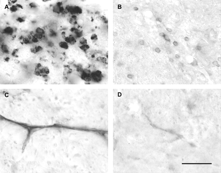 Examples of immunohistochemical labelling of macrophages, T lymphocytes and ICAM-1 in the spinal cord. Large numbers of ED1-positive macrophages are present at the site of an injection of LPS 7 days earlier (A). The number of OX 52-positive T lymphocytes is smaller at this time (B), but represents the maximal number of T lymphocytes observed within the dorsal funiculus at any time point examined (Table 1). Up-regulation of ICAM-1 on blood vessels is evident at the site of LPS injection within the dorsal funiculus 4 h after injection (C), compared with the very light labelling present in the dorsal funiculus of the same animal 2.5 cm rostral to the site of injection (D). The intensity of blood vessel labelling in naive spinal cord is similar to that shown in D (data not shown). Scale bar (shown in D) = 30 µm.