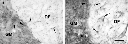Light micrographs showing GFAP immunoreactivity at the interface between the dorsal funiculus (DF) and the grey matter (GM) in an animal 7 days after the injection of LPS into the spinal cord. A transverse section 2 cm rostral to the injection site is shown in A, and a similar region at the site of LPS injection is shown in B. Note the fine labelling of astrocyte processes present at the site distant from the lesion in both the dorsal funiculus (arrows in A) and grey matter (arrowheads in A). Labelling of astrocytes is increased at the injection site, with thickened astrocyte processes in both the dorsal funiculus (arrows in B) and the grey matter (arrowheads in B), and an overall increase in labelling density in the grey matter. Scale bar = 50 µm.