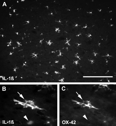 Epifluorescence photomicrographs of spinal cords 8 h after LPS injection. A shows a relatively low magnification image of a region of the dorsal funiculus labelled with an antibody against IL-1β. This proinflammatory cytokine is present in a large number of cells, most of which have multiple cell processes. The double-labelled section shown in B and C illustrates that many ramified cells at this time are positive for both IL-1β (arrow in B, visualized with fluorescein isothiocyanate) and OX-42 (arrow in C, visualized with rhodamine), a marker associated with quiescent microglia. Notice, however, that IL-1β-positive cells with a rounded morphology typically do not label with OX-42 (arrowheads in B and C), and are probably macrophages. Scale bar (shown in A) = 140 µm in A and 50 µm in B and C.