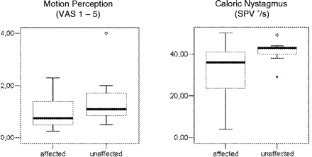 Box plots (median, 25% and 75% percentile, and minimal and maximal values) of the perceived motion sensation (visual analogue scale 1–5) and SPV (in °/s) of caloric nystagmus in the patients during caloric irrigation of the ear ipsilateral (affected) or contralateral (unaffected) to the thalamic lesion (one way ANOVA). t-Test and variation analysis were not significant for either parameter.