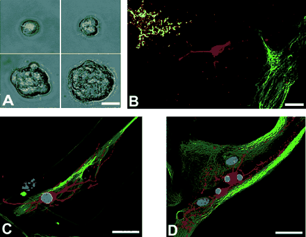 (A) The generation of a quaternary neurospheres. (B–D) Upon differentiation of tertiary spheres, cells positive for astrocytic (GFAP, green), neuronal [DCX, (B) red; MAP-2, C red] and oligodendrocytic markers [O4, B yellow; RIP, (D) red] develop. DNA is stained with TO-PRO (blue). Scale bars: 15 μm upper left + right, 25 μm lower left, 40 μm lower right (A); 20 μm (B + C); 40 μm (D).