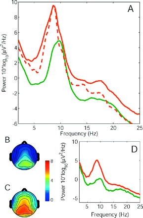 Average power spectra. The spectrum for the group of patients (red) and the group of healthy controls (green) with eyes closed (A). The global EEG power was enhanced in patients and the dominant peak was shifted towards lower frequencies in the patient population. The subgroup of six patients free from centrally acting medication showed the same effect in the 2–18 Hz frequency range (A, dashed line). The topographical distribution of EEG power (5–13 Hz, eyes closed) on the scalp of control group (B) and patient group (C) had a maximum at parietal electrode sites, but extended to more frontal regions in the patient group. (D) Upon opening the eyes, the power spectral density was reduced in both the groups, but theta overactivity persisted in the patient group.