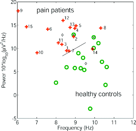 Individual subject EEG spectral parameters. Height and frequency of the dominant peak for each subject in the patient group (crosses) and the control group (circles). Numbers denote respective patients (Table 1). Using the parameters peak height and peak frequency, bivariate discriminant analysis (group centres: diamonds, misclassified subjects: ‘x’) classified 87% of all subjects correctly.