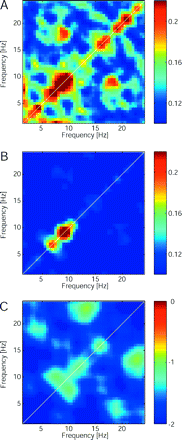Reduction of EEG bicoherence at the electrode FCz after the therapeutic lesion CLT. (A) Bicoherence values averaged over the patient subgroup (n = 7) before surgery. (B) One year after the surgery, off-diagonal peaks were diminished. (C) The Z-values for the paired comparison between bicoherence maps (Wilcoxon sign rank tests) show a general decrease of interfrequency coupling in the patient group 1 year after surgery.