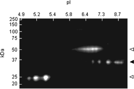 Western blot analysis of sorted inclusion proteins reveals several isoforms of hnRNP A2 (closed triangle). Open arrows represent anti-hnRNP A2 antibody components from FACS purification.