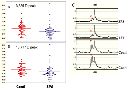 Proteomic profiling differentiates SPS from control group (A and B). The mean protein peak intensities of two different molecular sizes one at 13 835 kDa (A) and the other at 13 717 kDa (B) were found to be significantly lower (p < 0.05) in SPS compared to controls. Each spot represents a single patient, each run in duplicate. The mass spectrometric tracing in C shows the two identified protein peaks, 13 835 kDa and 13 717 kDa from two representative SPS patients compared with two controls. The peak at 13 717 kDa is marked with a red arrow.