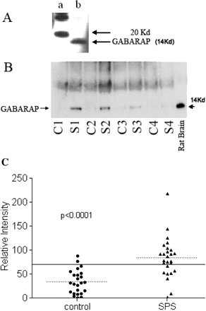 (A) Polyclonal antibody specificity to GABARAP. The polyclonal antibody to GABARAP developed in rabbit recognized the protein of expected 14 kDa size (lane b) in a western blot. Lane a represents molecular size markers. (B) SPS sera immunoprecipitate GABARAP. Sera from SPS and controls were used to immunoprecipitate GABARAP from rat cerebellum total protein extract. Western blots show GABARAP bands detected by the polyclonal antibody E2 from four representative SPS patients (S) and four controls (C). Total cerebellum protein was loaded in the last well (rat brain) and immunobloted with E2 antibody. (C) High prevalence of GABARAP antibodies in SPS sera. A total of 27 SPS sera and 19 controls were used to immunoprecipiate GABARAP from rat cerebellar total protein. The immunoprecipitates were resolved and the bands obtained on immunoblots were quantified using QuantityOne software. The reference sera used to normalize the band intensities of all the sera used was assigned an intensity value of 100. The dotted lines represent respective group means and the solid line indicates two times the mean of the control samples. A total of 19 of the 27 SPS samples and 2 of the 19 control samples had GABARAP antibodies above the cut-off (two times the mean of the controls).