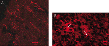 Confocal microscopy of anti-GABARAP immunoreactivity on cerebellar neurons. Immunostaining of rat cerebellum sections using E2 antibody demonstrates GABARAP immunoreactivity on the axons in the molecular layer (A) as well as neuronal cell bodies and processes (see arrows) in the granular layer (B). Polyclonal rabbit pre-immune serum was used as a negative control.