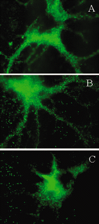 Inhibition of cell-surface expression of GABAA-receptor by SPS sera. Rat hippocampal neurons were treated in vitro with medium alone (A), with control IgG (B) or with an SPS patient IgG (C) for 4 h (magnification ×100). Immunostaining of GABAA-receptor γ2 subunit on representative cell body and neuronal processes demonstrates significant inhibition of the surface expression of GABAA-receptor on neuronal processes (C). Reduction of GABAA-receptor expression was also observed on the cell bodies of some neurons. The IgG purified from an OND subject that did not have detectable GABARAP antibodies, had no effect (B).