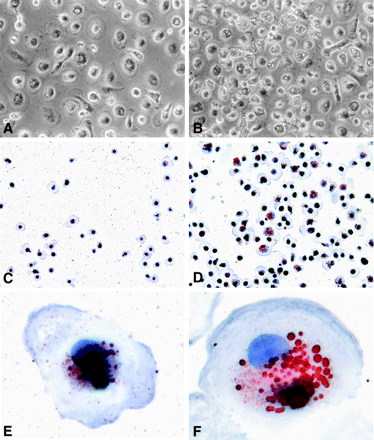Human in vitro model for myelin-driven foamy macrophage formation. Human monocyte-derived macrophages were cultured in the absence (A, C, E) or presence (B, E, F) of human brain-derived myelin for 24 h. Whereas cells cultured in the absence of myelin did not appear foamy (A, magnification ×32), those cultured with myelin acquired a characteristic foamy morphology as observed by light microscopy (B, magnification ×32). (C) Fewer macrophages contained neutral lipid-containing vesicles compared to (D) myelin-laden macrophages. (E) Macrophages contained smaller and fewer neutral lipid-containing vesicles than (F) myelin-laden macrophages. E and F are enlargements of C and D, respectively.