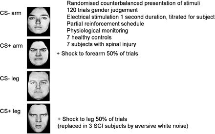 Task design. Subjects were scanned during Pavlovian aversive conditioning. Face stimuli (two female, two male, all with angry expressions) were presented in randomized order on a video monitor and the subject judged the sex of each face via two-choice button press response. In a 50% reinforcement schedule, two of the faces (CS + arm, CS + leg) were associated with delivery of aversive electrical stimulation (shock) to the arm and leg, respectively. Same gender faces (CS – arm, CS – leg) represented safe trials where there was no delivery or threat of shock. Stimuli were counterbalanced across subjects. Physiological cardiovascular responses (heart rate, pulse amplitude) were monitored using pulse oximetry. SCI patients were unaware of leg stimulation as this was below the sensory level of their spinal lesion. In the first four SCI patients, no behavioural conditioning to the CS + leg (or related brain activity) was demonstrated. To exclude a possibility that the ‘globally greater’ aversive experience of controls might confound interpretation of group differences, for the remaining three SCI patients studied the ‘CS + leg’ stimulus was associated to a headphone delivered burst of aversive white noise [500 ms, 100 dB (A)].