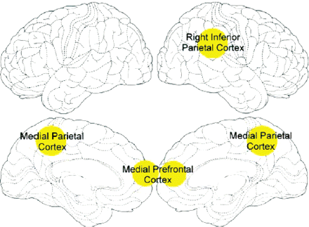 Schematic representation of the main cortical regions activated during first-person perspective tasks [reprinted with permission from Vogeley and Fink (2003)].