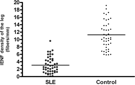 Reduced IENF densities in SLE. IENF densities of SLE patients (open circles) were markedly reduced compared with those of age- and gender-matched control subjects (closed circles) (3.08 ± 2.17 versus 11.27 ± 3.96 fibres/mm, P < 0.0001). The bars show mean values.