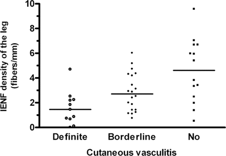 Association of cutaneous vasculitis with IENF densities in SLE. SLE patients with definite vasculitis (open circles) had significantly lower IENF densities than those with borderline vasculitis (closed circles) [1.45 (0.00–4.70) versus 2.71 (0.75–6.02) fibres/mm, P = 0.025]. IENF densities in patients with borderline vasculitis were lower than those with no vasculitis (squares) [4.61 (0.52–9.58) fibres/mm, P = 0.048]. The bars show median values.