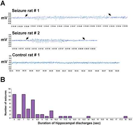 Typical spontaneous electrographic seizures recorded from hippocampal electrodes in adult rats that had sustained prolonged febrile seizures (FS) early in life. Seizures were defined as events meeting both EEG and behavioural criteria: electrographic parameters included presence of polyspikes or sharp-wave trains lasting over 6 s (see Materials and methods). (A) Hippocampal EEGs. Arrow points to onset and end of epileptiform discharges. The typical behaviour associated with these events was sudden cessation of activity accompanied by facial automatisms. Typically, behaviour changes slightly preceded the onset of hippocampal seizures, and lasted longer. Hippocampal EEG from a normothermic control rat shows low amplitude baseline trace. (B) Histogram of the duration of hippocampal EEG-recorded spontaneous seizures in adult rats that had endured prolonged FS early in life.