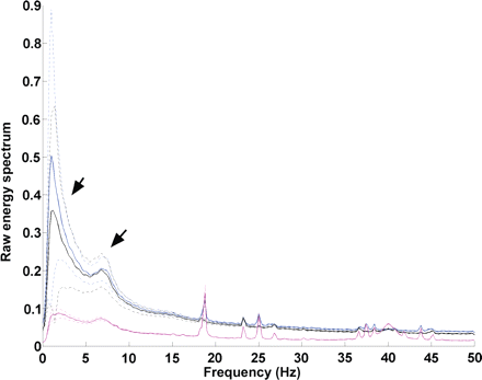 Raw energy spectra of individual nocturnal hippocampal EEGs from rats with febrile seizures (FS)-evoked spontaneous seizures (pink; n = 6) compared with FS-experiencing rats with epileptiform interictal discharges only (black; n = 9) and to normothermic control rats (blue; n = 8). A significant reduction of low-frequency energy (arrows) is apparent in rats with spontaneous seizures (epileptic), suggesting that these seizures may perturb global neuronal network activity. For each group, the solid line represents the mean of the raw energy; dashed line denotes the standard errors.