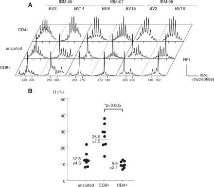 Immunoscope analysis of blood CD4+ and CD8+ T-cell repertoires. CD4+ and CD8+ blood T cell were purified by immunomagnetic sorting. (A) Comparison of immunoscope profiles in two representative BV families where T-cell expansions were observed in the unsorted T-cell population. (B) Quantification of T-cell repertoire perturbations. Numbers are mean ± SEM. The difference between average perturbation D (%) of CD4+ and CD8+ subsets was statistically significant.