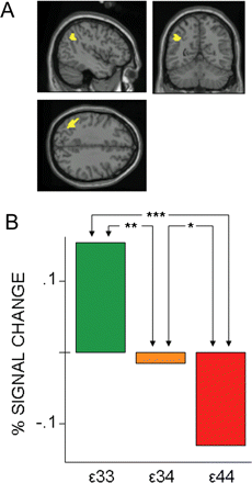 Dose-dependency of the APOE ε4 in the activation pattern: subgroup (n = 10) comparison of left parietal response. (A) The anatomical search was constrained by means of a functional ROI derived from the group contrast (Fig. 1C). (B) The dose of APOE ε4 predicted the failure to recruit the left parietal region (BA 39), (x = −44, y = −56, z = 36). In bar graph, *P < 0.1; **P < 0.05; ***P < 0.01 (one-tailed).