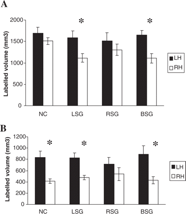 Mean interhemispheric volume difference (±SE) measured for HG for the three speech groups compared with a normal control group from the study of Penhune et al. (1996). (A) Grey-matter volumes. (B) White-matter volumes. NC = normal control group; LSG = left speech group; RSG = right speech group; BSG = bilateral speech group; LH = left hemisphere; RH = right hemisphere. The asterisk (*) = significant interhemispheric differences, P < 0.0001.