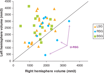Scatterplot displaying the labelled volumes for HG (grey and white matter summed together) for the three speech groups, showing in particular the three RSG subjects (unusual-RSG: U-RSG) who had a more pronounced right larger than left volume difference.