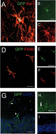 Morphological features of engrafted GFP+ BMCs in the brains of uninfected recipient mice 8 weeks after transplantation. (A–C) Confocal image of an engrafted cell in the hippocampus with typical microglial shape and distinct arborization pattern expressing both GFP (B, green) and the macrophage/microglia-specific marker Iba-1 (C, red). The overlay of confocal microscopic images (A) shows that the fluorophores are in the same cell. (D–F) Donor-derived hippocampal microglia also expressed the pan-macrophage marker F4/80. (D) Overlay, (E) GFP (green), (F) F4/80 (red). (G–I) In the cerebellum GFP-labelled microglia were predominantly visible in the molecular layer (arrowhead), whereas the granule cell layer (arrow) remained largely free of engrafted cells. (G) Overlay, (H) GFP (green). Note the autofluorescence of neurons in the granule cell layer (arrow). (I) DAPI staining (blue) of nuclei. Scale bars = 20 μm (A) or 10 μm (B, C, D and G) or 5 μm (E, F, H and I).