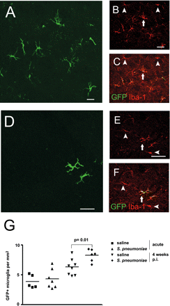 Increased number of donor-derived microglia in the cerebellum 1 month after bacterial meningitis. (A–F) Histological sections from the cerebellum revealed enhanced microglial engraftment in the cerebellum 4 weeks after meningitis (A–C) compared with mice treated with saline only (D–F). Some Iba-1+ microglia were brain endogenous cells (arrowheads), whereas others were newly recruited (arrows). (A and D) GFP (green), (B and E) Iba-1 (red), (C and F) overlay (yellow). (G) Quantification of cellular engraftment in the cerebellum during acute meningitis and 4 weeks after infection compared with saline-treated animals. Each symbol represents one individual animal. Scale bars = 20 μm (A), 10 μm (B, C, E and F) and 25 μm (D).