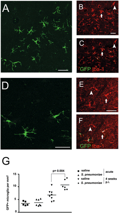 Enhanced recruitment of GFP+ microglia in the temporal cortex during the resolution of inflammation. (A–F) Confocal images illustrating morphology and distribution of GFP-expressing microglia derived from blood monocytes in the temporal region either 4 weeks after meningitis (A–C) or without bacterial challenge (D–F). Some cells express Iba-1 only (arrowheads) but others co-express GFP and Iba-1 (arrows). (A and D) GFP (green), (B and E) Iba-1 (red), (C and F) overlay (red). (G) Quantitative assessment of GFP+ microglia per square millimetre. Individual mice and the mean per group are shown. Scale bars = 30 μm (A and D) and 10 μm (B, C, E and F).