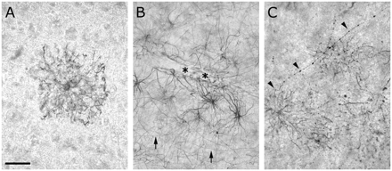 Differentiated astrocytes in the adult human neocortex expressed DCX (Chemicon). (A) Solitary astrocyte in layer III. (B) Astrocytes contacting a bloodvessel in the border area of layer VI and white matter. Arrows indicate typical fibres of the white matter and the lower cortical layers. Asterisks indicate astrocytic endfeet. (C) A polarized astrocyte with an ascending fibre (arrow heads) in the border area between layer VI and white matter. Scale bar is 32 μm in A; 50 μm in B and C.