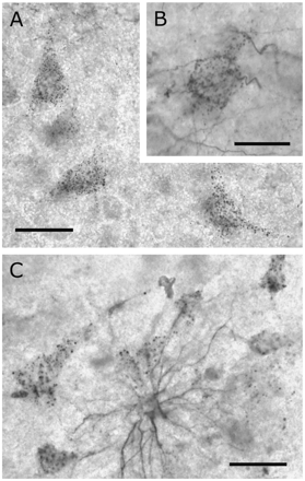 DCX+ (Chemicon) neurons were predominantly present in the middle cortical layers. (A) Neuronal doublecortin staining was punctate and appeared to envelope the somata. (B) Some neuronal profiles were contacted by tiny DCX+ fibres. (C) In exceptional cases astrocytes were found to contact several surrounding neurons. Scale bar is 30 μm in A; 20 μm in B; 40 μm in C.