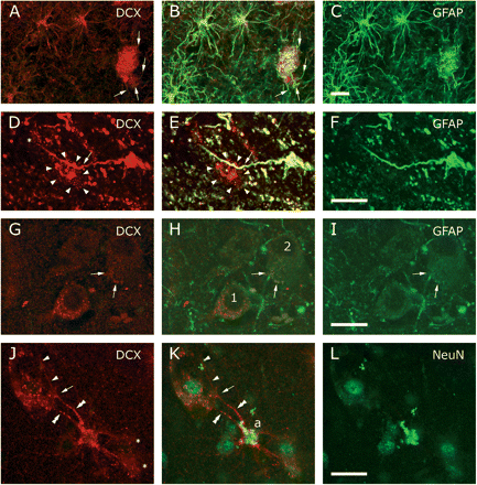 A minority of the neocortical astrocytes was positive for DCX. (A–C) DCX+(Chemicon)/GFAP+ astrocytes and peripheral processes ending in a patch of punctate DCX+/GFAP+ staining. Arrows (A, B) mark afferent processes. (D–F) A predominantly DCX+ (Santa Cruz) neuronal envelope (arrow heads) contacted by a passing process emanating from a DCX+(Santa Cruz)/GFAP+ astrocyte. An asterisk indicates a part of another envelope. (G–I) Often the DCX+ (Chemicon) punctae seemed to be completely segregated from contacting GFAP-containing processes (cf neuron 1), whereas on other neurons (cf neuron 2) part of the processes and punctae contained both GFAP and DCX (arrows). (J–L) Double labelling with DCX (Chemicon) and NeuN supported the idea that DCX is not present in the neuronal cytoplasm but envelopes the soma. Two processes (double arrow heads) emanated from a DCX+ astrocyte (a). One process branched (arrow) where it seemed to touch the neuronal surface, forming a punctated veil and a proceeding branch (arrow heads). Asterisks in J mark other envelopes provided by the astrocyte. B, E, H and K show the merged images. Scale bars are 20 μm.