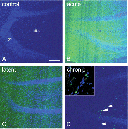 Albumin immunocytochemistry in the rat hippocampus. In control rats (A) albumin could not be detected in the dentate gyrus of the hippocampus. Sections were counterstained with DAPI (blue) to visualize cells. In the acute (B) and latent phase (C), albumin extravasation was evident throughout the dentate gyrus (green). In chronic epileptic rats (D) albumin was present in the dentate gyrus (arrowheads), but not as widespread as acutely after SE. Inset in D shows high magnification of the hilus, containing albumin particles (green). Scale bar = 100 μm, gcl = granule cell layer.