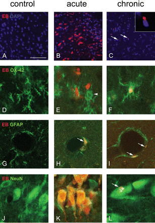 Evans Blue (EB) extravasation during epileptogenesis. In control rats, no EB staining (red) was observed microscopically (A, D, G and J). In the acute seizure period EB (red) was abundantly present (B). EB colocalized with the microglial marker OX-42 (E, arrowhead shows activated microglia migrating towards EB particle) and astrocytic marker GFAP (H) and the neuronal marker NeuN (K). In chronic epileptic rats increased EB staining was observed microscopically, mainly in layer III of the piriform cortex (C). Inset shows high power magnification. EB colocalized with reactive microglial cells (F) and astrocytes that surrounded blood vessels (I). Sparse labeling was found in neurons (L). Scale bar A–C = 100 μm, inset in C = 18 μm, D–F = 20 μm, G–I = 25 μm, J–L = 20 μm.