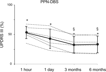 Decline over time of PPN-DBS efficacy. The plot shows the percent (%) amelioration mediated by 1 h PPN-DBS in OFF-medication. The >40% clinical amelioration appreciable at 1 h decreases slightly at 1 day of postsurgery period and further in the subsequent follow-up. A steady-state response is reached only at 3 months. The UPDRS-III score at 3 and 6 months is, indeed, significantly worse (§) than the acute early assessments.