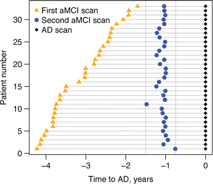 Time-line representing the time of each MRI scan for each individual (n = 33) relative to progression from aMCI to a clinical diagnosis of AD. The black diamonds represent the scan at the time of the diagnosis of AD. The blue circles represent the scans classified as being 1 year (9–18 months) before the diagnosis of AD. The orange triangles represent the scans classified as being 3 years (18–51 months) before the diagnosis of AD.