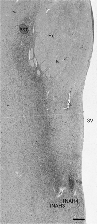 Photomicrographs depicting the dense band of NPY fibers which connect the bed nucleus of the stria terminalis and the uncinate nucleus (A) NBB # 83004, virilized woman of 46 years of age with an adrenal tumour. Because the adrenal tumour was giving rise to high cortisol, androstendione and testosterone plasma levels, this patient was not included in the measurements. Fx = fornix, INAH3 and 4: interstitial nuclei of the anterior hypothalamus 3 and 4, 3V: third ventricle. Note the extra dense innervation of INAH3 and 4. Scale bar = 250 µm.