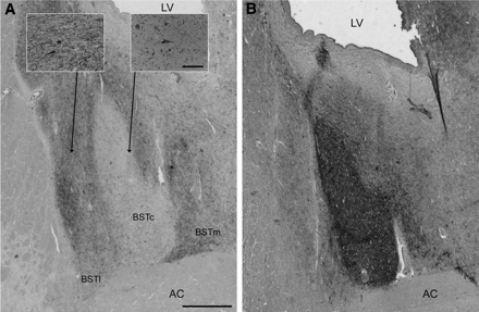 Innervations of the different subdivisions of the BST by NPY (A) and somatostatin (B). Note that the two stainings are complementary. The two inserts in (A) show the difference in the density of NPY fibers and cells in lateral/medial BST and in central BST subdivision Scale bar = 50 μm. LV: lateral ventricle, AC = anterior commisure; BSTl, c, m = Bed nucleus of the stria terminalis lateral, central and medial subnucleus. Scale bars = 375 µm.