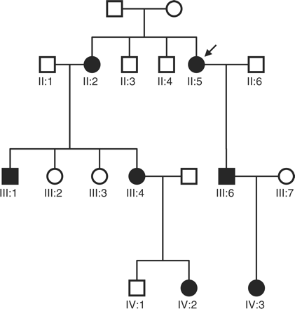 家系显示一个常染色体显性外眼肌麻痹伴视神经萎缩和共济失调的家族中的男性（方形）和女性（圆形）。实心符号=如文中所述，受临床影响。