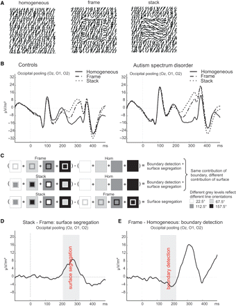 (A) The stimuli used in the discrimination task while EEG activity was measured. (B) The EEG responses (converted to spline laplacian's) to the stimuli for controls and subjects with ASD, before any subtraction. (C) The subtractions that were made to isolate activity related to boundary detection and surface segregation. Different grey levels represent different line orientations. (D) The stack–frame subtraction wave (for control subjects) to determine the time window, indicated by the grey panel, related to surface segregation. (E) The frame–homogeneous subtraction wave (for control subjects) to determine the time window, indicated by the grey panel, related to boundary detection.