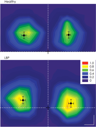 Average normalized motor cortical maps for the healthy and LBP groups on the left and right hemisphere. Mean and SD of the CoG is displayed. The black cross represents the location of vertex, horizontal dotted line denotes the inter-aural line and vertical dotted line denotes the line that connects the nasion and inion (Calibration –1 cm).