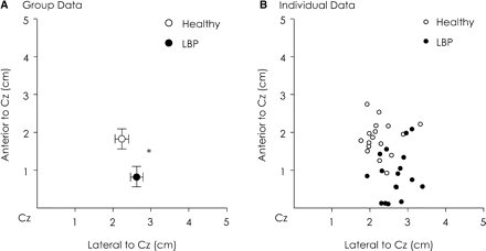 Group (A) and individual data (B) of the CoG of TrA. Note that for group data, the location of TrA CoG in LBP group was located posterior and lateral to TrA CoG in healthy groups (*P < 0.05). This was observed in most subjects.