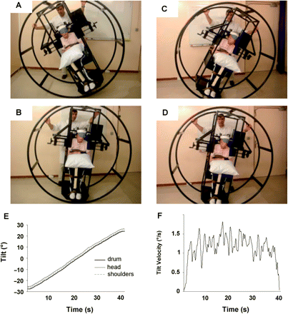 The wheel paradigm for measuring the postural vertical in disabled patients. The subject is randomly tilted to either side of true vertical between 15° to 45°, the wheel is then rolled immediately in the opposite direction until the subject reports having reached an upright position. Example of two trials in a patient with a right hemisphere stroke and left lateropulsion. (A) starting position on the right, the patient feels upright in (B), and (C) starting position on the left, the patient feels upright in (D). PV calculated as the average of 10 trials performed in a pseudo-random sequence was −11°. (E) manual rotation of the wheel with a subject strapped inside, measured using a precise movement analysis system (BTS Smart-e). Wheel rotation induces the same body rotation without unwanted movement of the head or trunk, which passively follow the wheel orientation. (F) the derivative of the wheel position signal (velocity) shows that the mean angular velocity was around 1–1.5°/s, except when the movement starts/stops for minor positional adjustments.