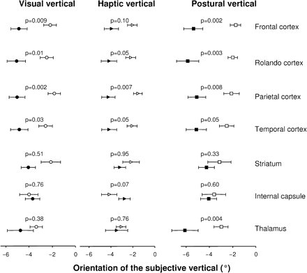 Comparisons of VV, HV and PV between patients in whom a given cerebral structure was involved by the stroke (black symbols) and patients in whom this cerebral structure was anatomically intact (spared by the stroke; open symbols). Data are given as means ± SE with a level of significance set at 0.007 (see main text).