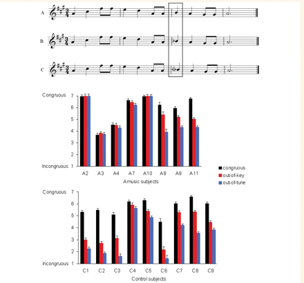 Example of a congruous melody (A), an incongruous melody with an out-of-key tone (B) and a mistuned tone by a quarter tone ( in C). Target tones were 500 ms long. The mean ratings given by each amusic and each control subject, as a function of the target tone condition, are presented below. Bar indicates standard error.