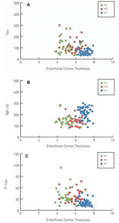 Scatter plots illustrating the relationship between total entorhinal cortex thickness and CSF measures of (A) tau protein, (B) abeta 42 protein and (C) p-tau protein for 33 Alzheimer's disease (green circles), 30 MCI (red circles) and 52 older controls (blue circles) individuals. Cortical thickness values are expressed in mm and CSF measures are expressed in picograms per mm.