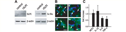  Altered SLPI, Iκ-Bα, and cytokine levels in the spinal cord of recombinant mouse SLPI-treated mice after spinal cord injury. (A) Western blots for SLPI and Iκ-Bα show increased levels of both proteins in the spinal cord of mice 12 and 24 h, respectively, after spinal cord injury in mice injected with recombinant mouse SLPI, as compared to vehicle-treated controls. β-actin is used as a loading control (n = 3 per group). (B) Micrographs of small rounded SLPI+ cells ∼10–12 μm in diameter (arrows in panels i–iii) that appear to be leukocytes located in the dorsal injured part of the spinal cord from mice 12 h after recombinant mouse SLPI injection and spinal cord injury. In panel (iv) SLPI+ cells (arrows) are seen on the outer side of blood vessels that may be cells that have migrated out of the circulation. Scale bar = 15 µm. (C) Quantitative real-time PCR analysis of mRNA expression of pro-inflammatory chemokine and cytokine expression 12 h after spinal cord injury shows a significant reduction in TNF-α mRNA levels (*P < 0.05; n = 3 per group) in mice treated with recombinant mouse SLPI. No changes are seen in monocyte chemotactic protein-1, IL-6 and IL-1β mRNA levels (n = 3 per group). Data represent fold increase over vehicle-treated controls (horizontal line) also taken 12 h after spinal cord injury.