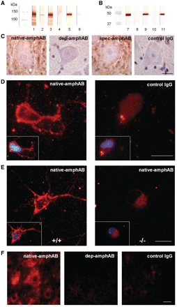 Selective binding of anti-amphiphysin antibodies to neuronal tissue. Western blotting of purified IgG (1 mg/ml) on rat spinal cord tissue (A) and on a glutathione S-transferase SH3 domain fusion protein (B) displayed specific binding of anti-amphiphysin antibodies (lanes 1 and 7: native-amphAB IgG; 3 and 9: spec-amphAB from Patient 1; 4 and 10: control IgG; 5 and 11: commercial, polyclonal anti-amphiphysin antibodies). Affinity chromatography resulted in almost complete depletion of anti-amphiphysin antibodies (lanes 2 and 8: dep-amphAB; 6: native-amphAB at 1000× lower concentration). (C) Naïve rat spinal cord sections were incubated with IgG (n = 3 for each IgG preparation). Incubation with native-amphAB and with spec-amphAB from Patient 1 resulted in distinct staining of neuronal plasma membranes and dendrites, indicating specific binding to neuronal surface structures. After depletion of anti-amphiphysin antibodies these staining properties were completely absent. Control IgG at the same concentration showed no immunoreactivity (scale bar: 30 µm). (D) Incubation of a rat spinal motor neuron-interneuron co-culture with native-amphAB IgG and subsequent immunoreaction against human IgG antibodies resulted in an intense punctate staining of the cell membrane, soma and dendrites, whereas control IgG elicited only faint staining of cell bodies (representative sample out of three for each IgG preparation; scale bar: 20 µm). Inset shows overlay of the same neurons with DAPI). (E) Incubation of wild-type (+/+) mouse motor neurons with native-amphAB revealed a similar staining pattern as in D (left panel), whereas motor neurons from amphiphysin knockout mice (–/–) did not (scale bar: 20 µm). (F) Treatment of rats with pathogenic native-amphAB, but not with dep-amphAB or control IgG, resulted in intense staining of spinal motor neurons in lumbar spinal cord sections (scale bar: 30 µm).