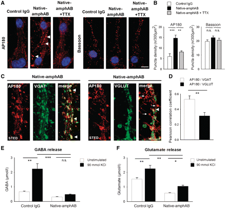 Functional effects of autoantibodies on GABAergic and glutamatergic synapses. (A and B) Confocal imaging of mouse hippocampal neurons treated either with native-amphAB or control IgG revealed enhanced clustering (arrowheads) of the endocytic protein AP180, but not of the active-zone protein bassoon in neurons pre-incubated with anti-amphiphysin antibodies as compared with control IgG. AP180 was redistributed in cultures when synaptic network activity was blocked by tetrodotoxin (TTX; **P < 0.01; scale bar 10 µm). (C and D) Clustering of the endocytic protein AP180 occurs preferentially at GABAergic synapses. High-resolution stimulation emission depletion microscopy revealed significantly more overlay of GABAergic synapses (stained with VGAT) with clusters of AP180 (arrowheads), as compared with glutamatergic synapses (stained with VGLUT) (arrows; scale bar 5 µm; **P < 0.01). (E and F) Following incubation with native-amphAB high-performance liquid chromatography analysis of cell culture supernatant revealed a substantial decrease of GABA release (down to 21.8% compared with incubation with control IgG) and, to a lesser extent, of glutamate release (down to 46.6%; P < 0.01). Stimulation with 90 mM K+ in anti-amphiphysin IgG treated cell cultures did not result in an increase of GABA release, but did increase glutamate release. This indicates a more pronounced alteration of inhibitory as compared with excitatory synaptic activity (*P < 0.05; **P < 0.01; ***P < 0.001).